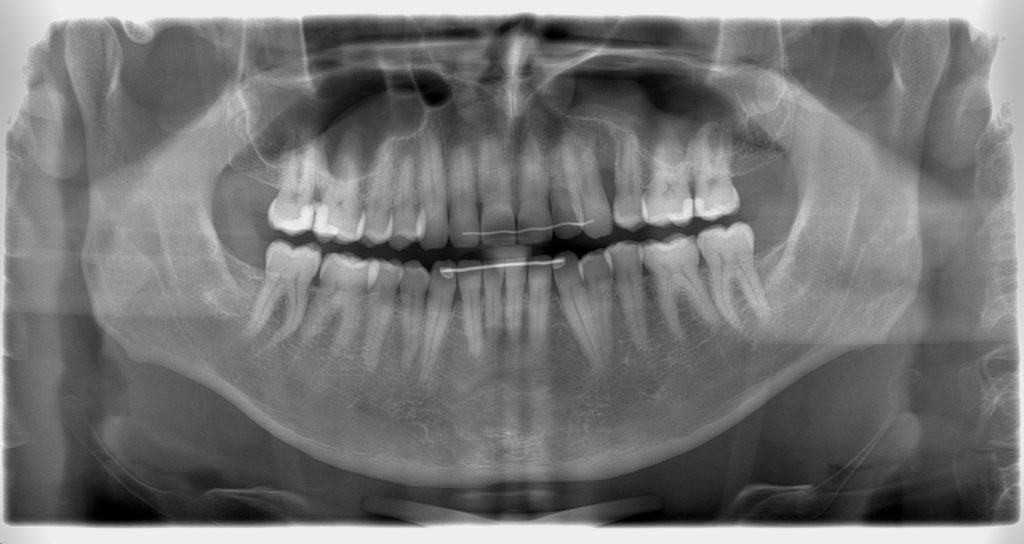 Our Technology Dentist Prescott AZ Prescott Dental Arts