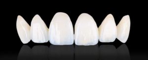 prescott az empress porcelain lateral and central incisor 