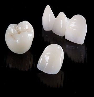 prescott az ips max lithium porcelain a molar, lateral and central incisor