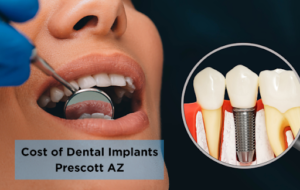 dental implant prescott AZ after the produre, with dental implant intimate view 